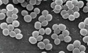 staphylococcus aureus