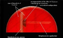 streptococcus ageptococco di galactiae (gruppo B)