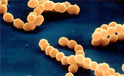 neisseria meningitidis (meningococco)