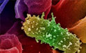 streptococcus ageptococco di galactiae (gruppo B)